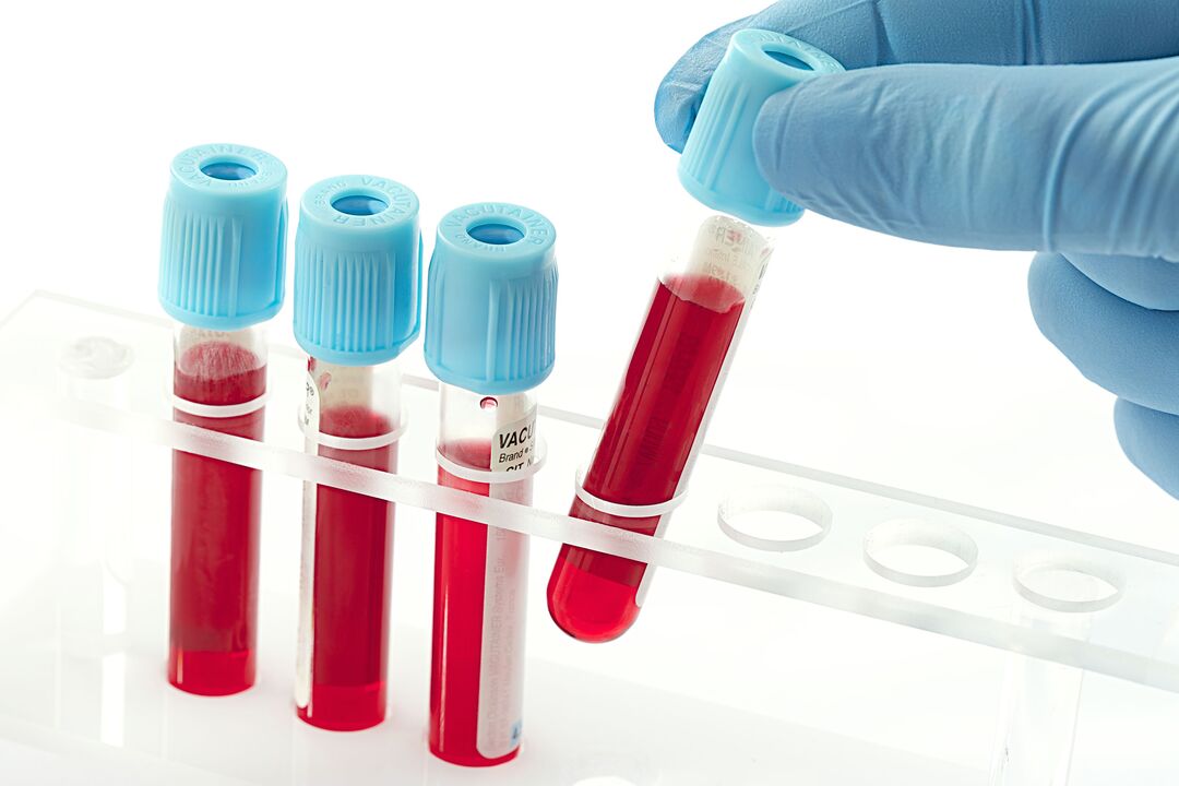blodprøve for at diagnosticere humant papillomavirus