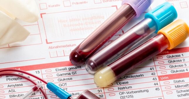 Blodprøve for humant papillomavirus