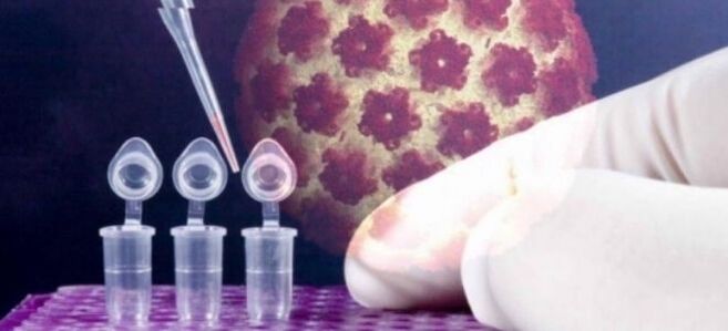 HPV-diagnostik ved hjælp af digene-testen